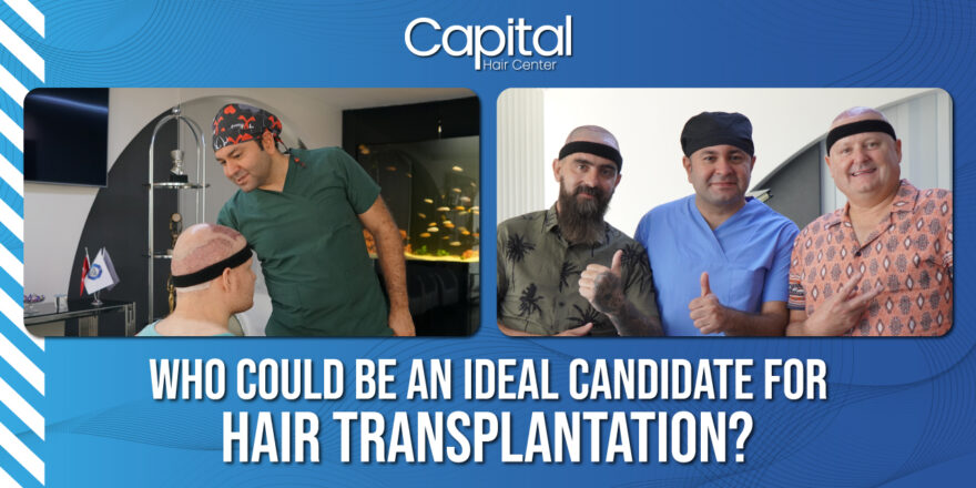 Who Can Be an Ideal Candidate for Hair Transplantation