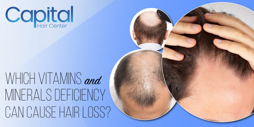 Which Vitamins and Minerals Deficiency Can Cause Hair Loss?