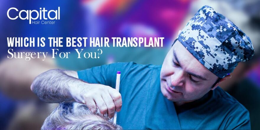 Which Is the Best Hair Transplant Surgery for You