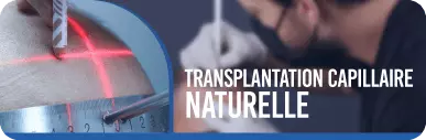 TRANSPLANTATION CAPILLAIRE NATURELLE